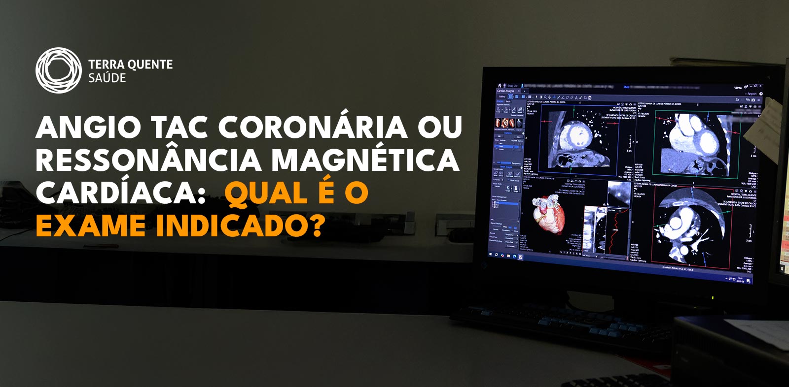 Angio TAC coronária ou ressonância magnética cardíaca: qual é o exame indicado?