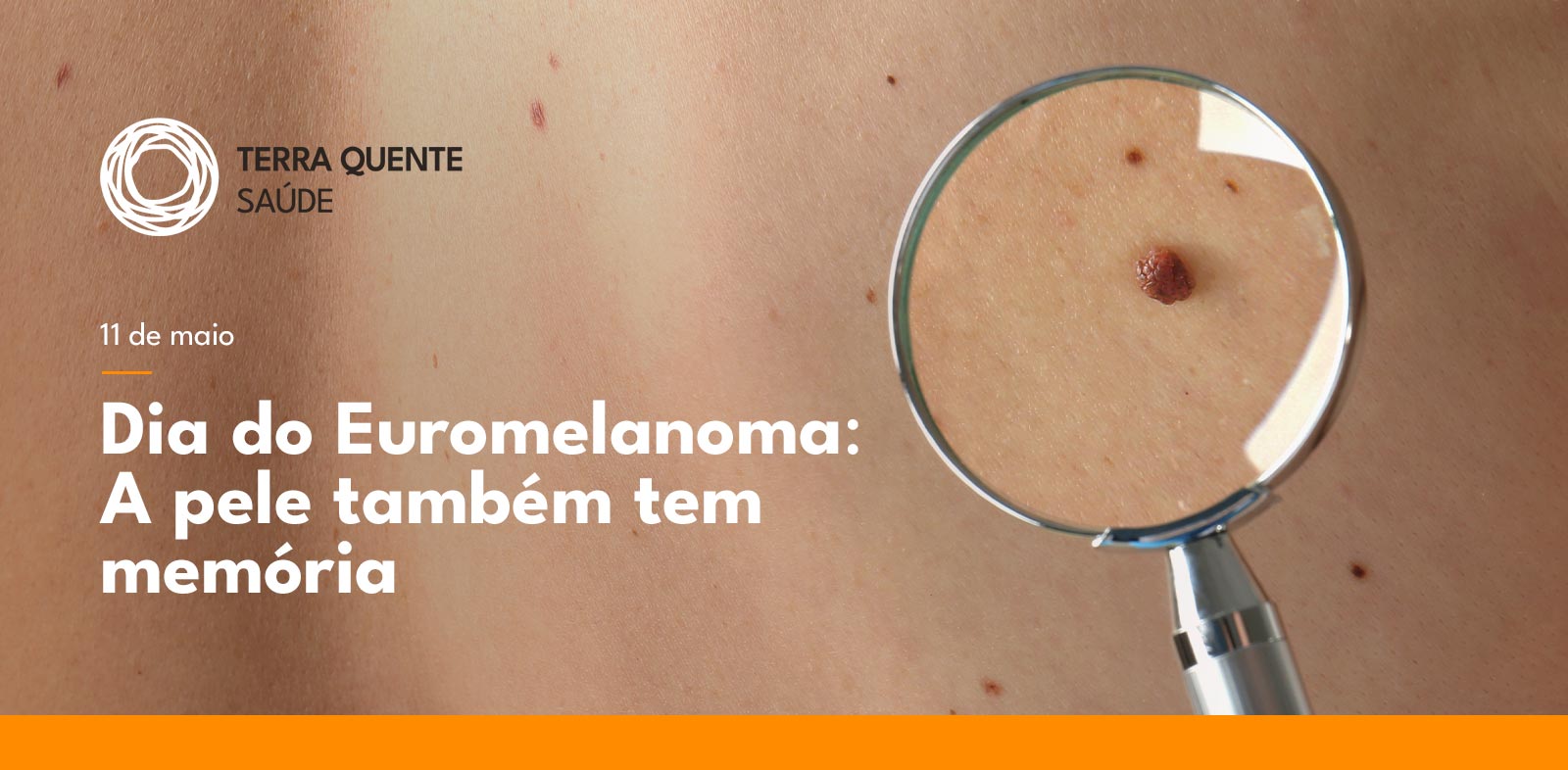 Dia do Euromelanoma: A pele também tem memória